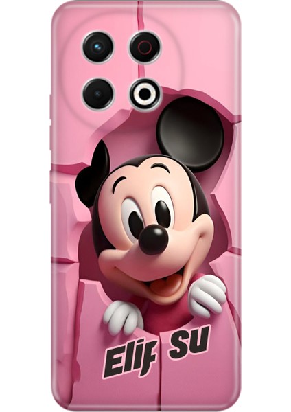 Oppo Reno A16 A54 A74 2z A5 A9 2020 4 5 6 7 Lite Kılıf Kişiye Özel Isim Yazılı Silikon Grafik-72