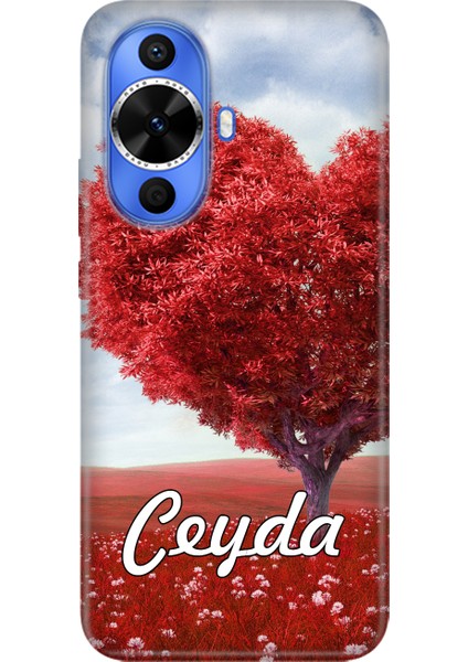 Xiaomi Mi 8 9 9t 10 11 12 13 15 Lite Pro Kılıf Kişiye Özel Isim Yazılı Silikon Ces-16 indirimleri