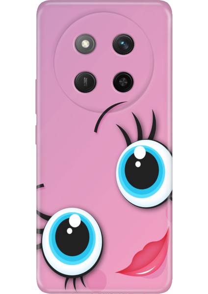 Honor X60 Pro - X9C 5g Kılıf Dekoratif Silikon Baskılı Kapak Sevgidolu