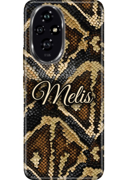 Omix X3 X5 X6 X7 X300 X400 X500 X600 X700 Kılıf Kişiye Özel Isim Yazılı Silikon Namefont4