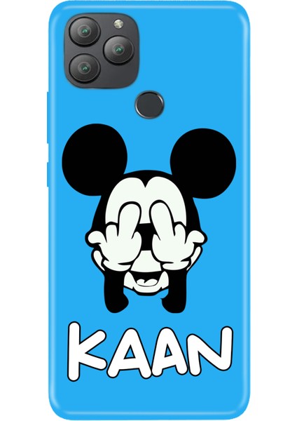 Xiaomi Redmi Note 7 8 9 10 10S 11 12 13 14 15 Pro Plus Kılıf Kişiye Özel Isim Yazılı Silikon Grafik-35 fırsatları