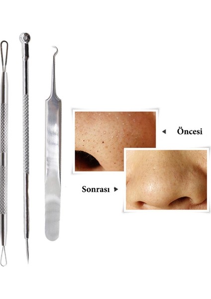 Paslanmaz Çelik Siyah Nokta Sivilce ve Akne Temizleyici Set 3'lü Kit