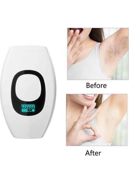 Lazer Epilatör Ipl Kadınlar Için Tüy Alma Vücut Yüz 999.999 Flaş Kalıcı Ağrısız Ipl Tüy Alma Cihazı Eu-Plug B (Yurt Dışından)