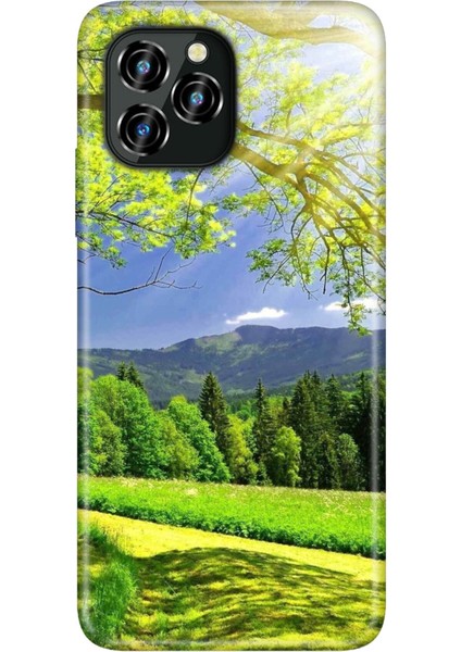 Oukitel C21 Pro Kılıf Silikon Desenli Resimli Uv Kapak Mis Oksijen