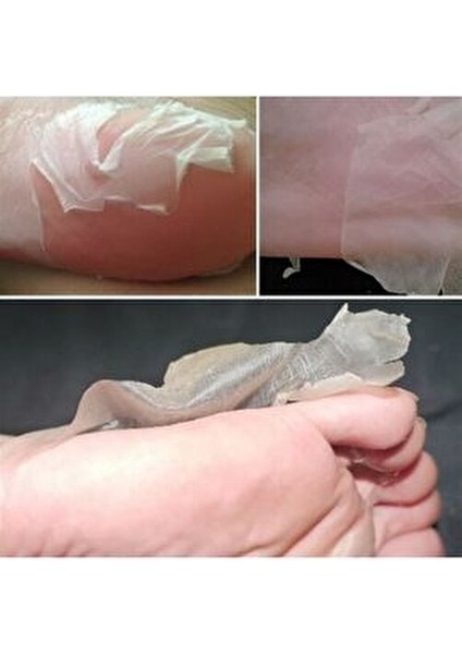 Peeling Etkili Ayak Maskesi Gözenek Sıkılaştırıcı Etkiyle 1 Çift fırsatları