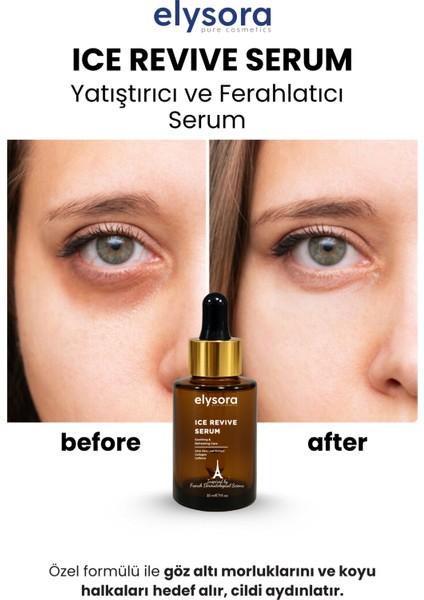 Göz Altı Morluk, Koyu Halka, Soğutucu ve Canlandırıcı Göz Serumu 30 ml fırsatları