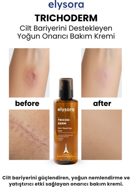 Sarı Kantaron Yağı Içeren, Cilt Bariyeri Onarıcı, Yatıştırıcı, Onarıcı Bakım Kremi 100 ml modelleri