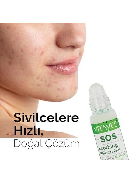 Vıtayes Sos Cilt Serumu - Akne ve Sivilce Önleyici, Siyah Nokta, Cilt Kızarıklığı, Kaşıntı, Sinek Böcek Isırması Karşıtı Onarıcı Çay Ağacı Yağı ve Provitamin B5 Serumu, Üçlü Ambalaj 30 ml fiyatları