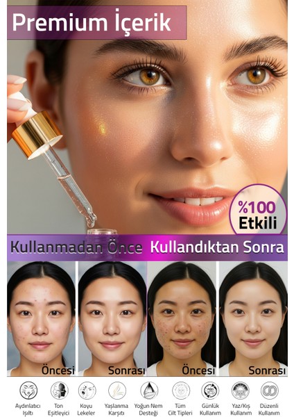 Leke Karşıtı & Cilt Tonu Eşitleyen Aydınlatıcı & Cilt Parlatıcı Serum 50 ml