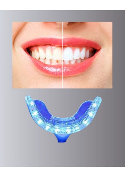 LED Işıklı Profesyonel Diş Beyazlatma Seti fiyatları