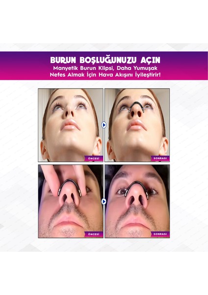 30’lu Mıknatıslı Siyah Burun Bandı - Estetik, 2025 Manyetik Breath Horlamayı Azaltıcı Nefes Açıcı Burun Dilatörü Aparatı fırsatları