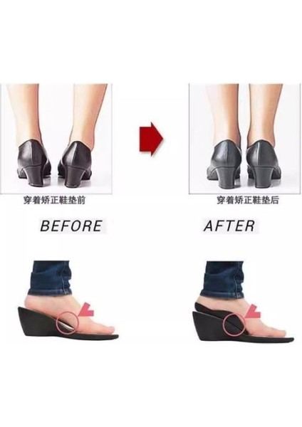 Esnek Düz Taban Düzeltici Topuk Yastığı