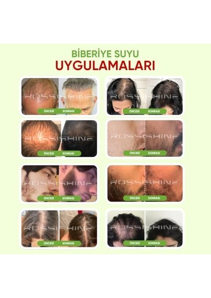 Saf Biberiye Suyu Dökülme Karşıtı ve Hızlı Saç Uzatma ETKILI%100 Doğal Saç Toniği 250 ml fiyatları