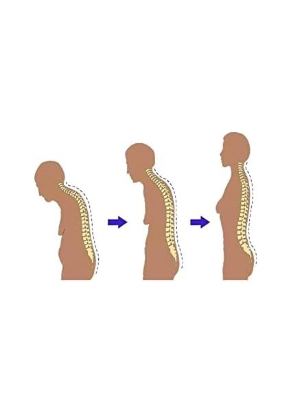 Ankanorm Balenli Dik Durmayı Sağlayan Sırt Korsesi Kadın-Erkek Kamburluk Önleyici Dik Duruş Korsesi modelleri