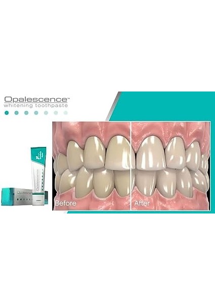 Opalescence Beyazlatıcı Sensitivity Relief Diş Macunu, 133GR modelleri