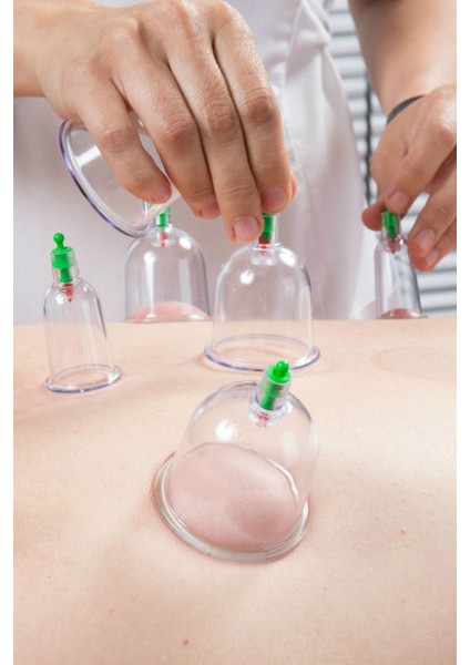 Vakumlu Hacamat Kupa Çekme Masaj Seti 12'li Pompa Dahil