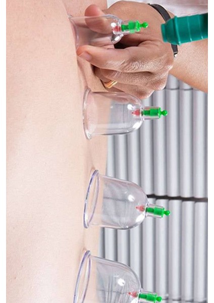 Vakumlu Hacamat Kupa Çekme Masaj Seti 12'li Pompa Dahil fırsatları