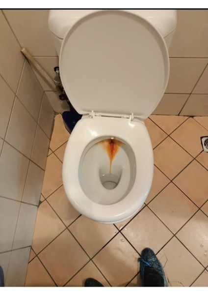 Wc Sarı Leke Temizleme Jeli - Sol Wc Perfect Jel 500ML 2 Adet fırsatları