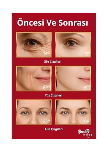 Boyun Yüz Sıkılaştırıcı Kırışıklık Giderme Aleti, Çift Çene Azaltıcı Titreşim Masajı Kırışıklıklar Görünüm Giderme ve Yüz Için Cilt Sıkılaştırma, Boyun fiyatları