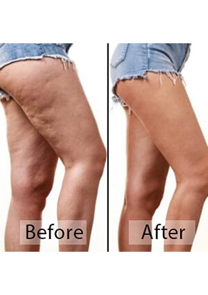 Selülit Giderici Ahşap Masaj Aleti, Akapunktur, Lenf Drenaj Masajı, % 100 Doğal El Yapımı