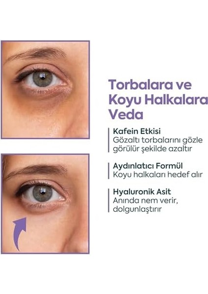 Clasycare Göz Altı Kremi - Kafein%5 + Hyaluronik Asit%2 - Morluk, Torba ve Şişlik Karşıtı Göz Kremi - Kırışıklık, Ince Çizgi ve Göz Altı Aydınlatıcı Krem, 40 ml