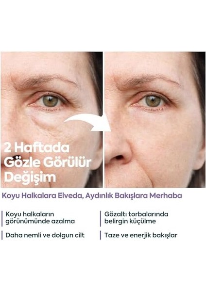 Clasycare Göz Altı Kremi - Kafein%5 + Hyaluronik Asit%2 - Morluk, Torba ve Şişlik Karşıtı Göz Kremi - Kırışıklık, Ince Çizgi ve Göz Altı Aydınlatıcı Krem, 40 ml modelleri