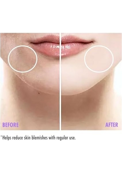 Maruderm Leke Karşıtı Cilt Serumu 30 ml modelleri