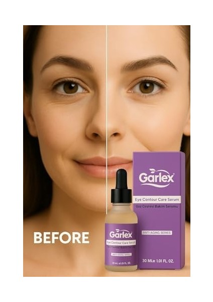 Garlex Göz Çevresi Bakım Serumu,30 ml