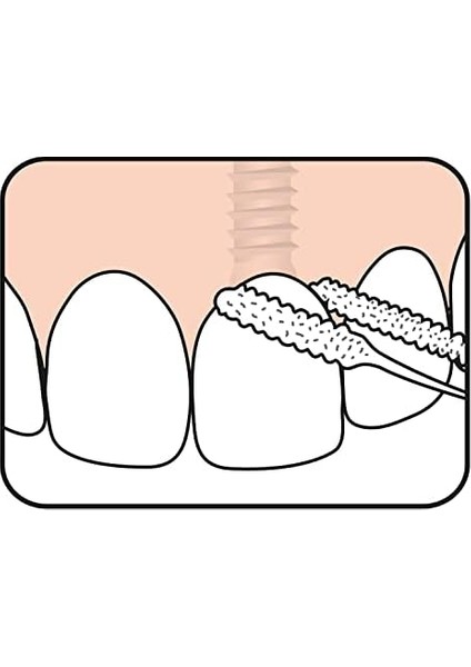 Tepe Bridge & Implant Floss (Diş Ipi) modelleri