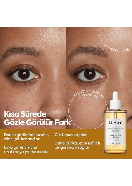 Clasycare Leke Karşıtı Aydınlatıcı Yüz Serumu – Niasinamid, Alpha Arbutin ve Hyaluronik Asit Içerikli Serum – Cilt Tonu Eşitleyici, Kore Cilt Bakımı, 50ML