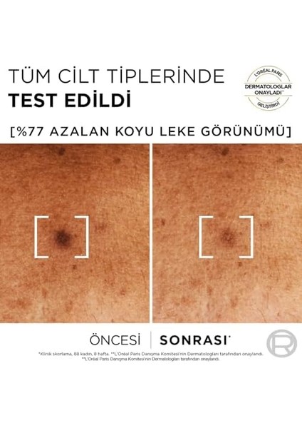 L'oréal Parıs Bright Reveal Sivilce, Güneş, Yaşlanma Lekelerinde Etkili Koyu Leke Karşıtı Serum, 10% Niasinamid, 30 ml modelleri