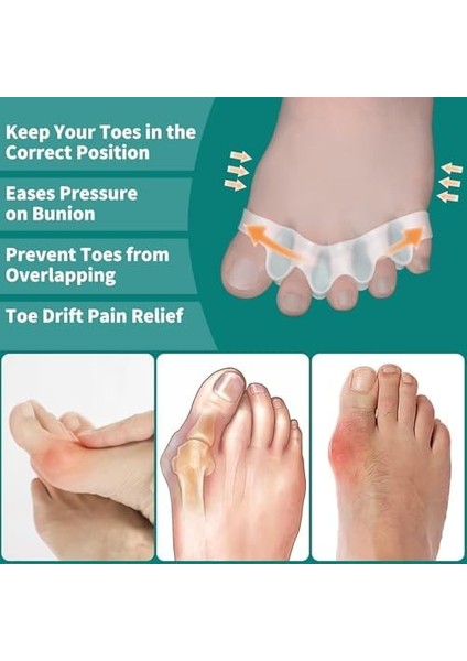 Kyrotech 5 Parmak Ayıran Silikon Makara – Bunyon Ayırıcı, Ortopedik Ayak Parmak Ayracı, Esnek ve Rahat Kullanım Beyaz 1 Çift modelleri