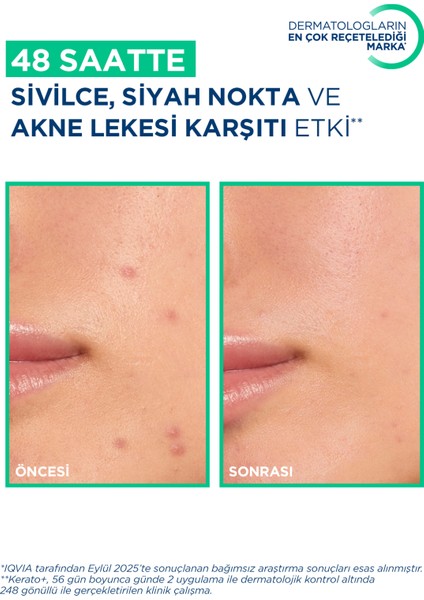 Sebium Kerato+ Sivilce, Akne Lekesi Karşıtı AHA, BHA, Salisilik Asit İçeren Bakım Kremi 30 ml indirimleri