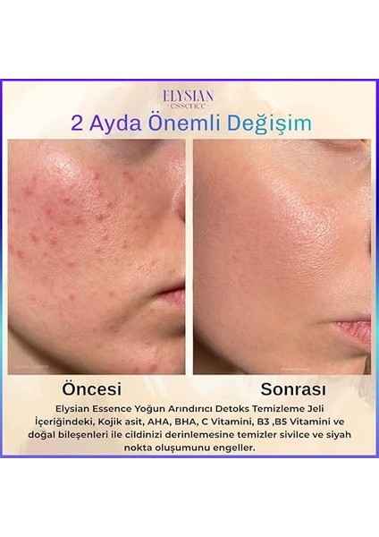 Elysian Essence Yoğun Arındırıcı Detoks Yüz Temizleme Jeli 2'li Set - Sivilce ve Siyah Nokta Karşıtı - Aha Bha - Kojik Asit 200 ml modelleri