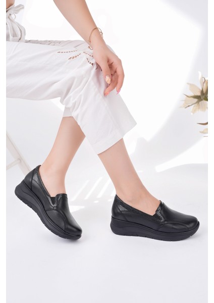 Kadın Hakiki Deri Siyah Kemik Çıkıntısına Özel Ortopedik Ayakkabı fiyatları