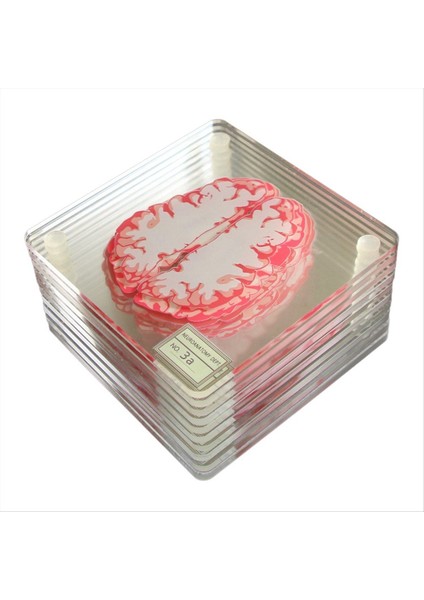Beyin Örnek Makineleri Seti 3D Organ Beyin Sanatları Beyin Dilimleri Kare Akrilik Içecekler Masa Coaster (Yurt Dışından)