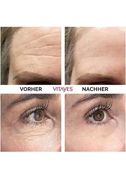Vitayes Instant Ageback Yaşlanma Karşıtı Kırışıklık Giderici Yüz Germe Kremi 7ml modelleri