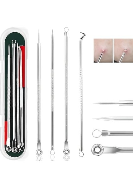 Aee® 4&apos;lü Kutulu Paslanmaz Çelik Komedon Akne Siyah Nokta Sivilce Siğil Temizleyici Çıkarıcı Seti Gümüş modelleri