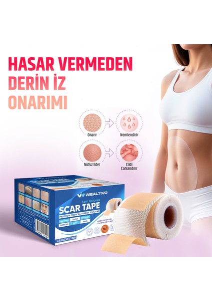 Silikon Yara Izi Bandı 2,5 M Skar Azaltıcı Soft Medikal Silikon Bant – Ameliyat/sezaryen/yanık/akne Izleri Için