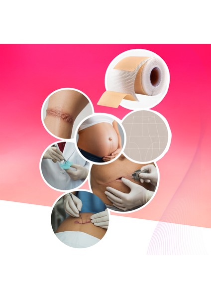 Silikon Yara Izi Bandı 2,5 M Skar Azaltıcı Soft Medikal Silikon Bant – Ameliyat/sezaryen/yanık/akne Izleri Için