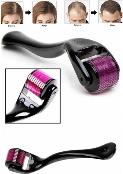 Ieg® Derma Roller Titanyum Uçlu 540 Iğneli 1 mm Saç Sakal Çıkarma ve Cilt Bakım Masaj Aleti