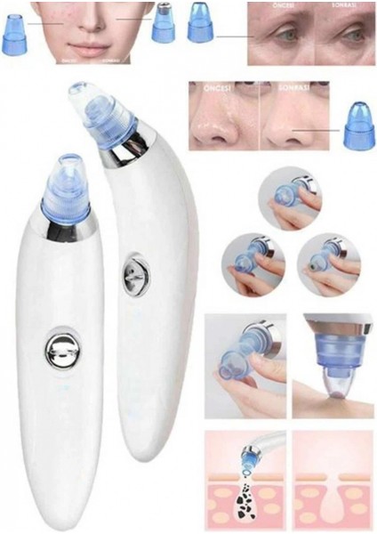 Ieg® Vakumlu Siyah Nokta ve Yüz Temizleme Cihazı 4 Başlıklı indirimleri