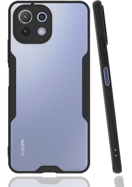 Xiaomi Mi 11 Lite Kılıf Platin Silikon - Siyah