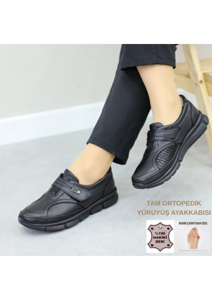 Tam Ortopedik Hakiki Deri Kaymaz Taban Kemik Çıkıntısı Ayakkabısı