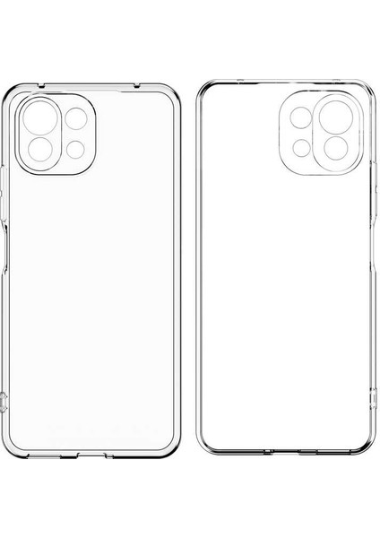 Xiaomi Mi 11 Kılıf Tcmk Kamera Korumalı Süper Silikon Kapak-Renksiz
