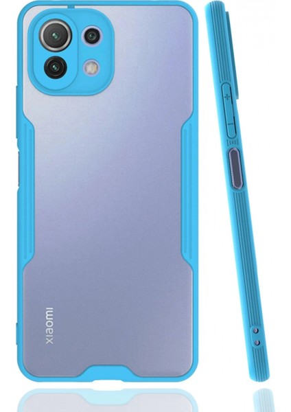 Ieg Xiaomi Mi 11 Lite Kılıf Platin Silikon - Mavi