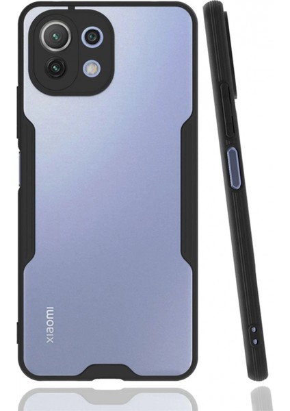 Ieg Xiaomi Mi 11 Lite Kılıf Platin Silikon - Siyah