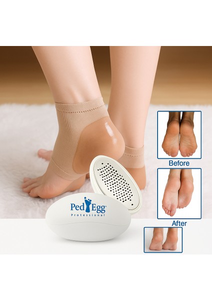 Ayak Bakım Paketi – Ped Egg Topuk Törpüsü + Silikon Topuk Nemlendirici Çorap Seti | Çatlak Karşıtı, Yumuşatma ve Spa Etkili