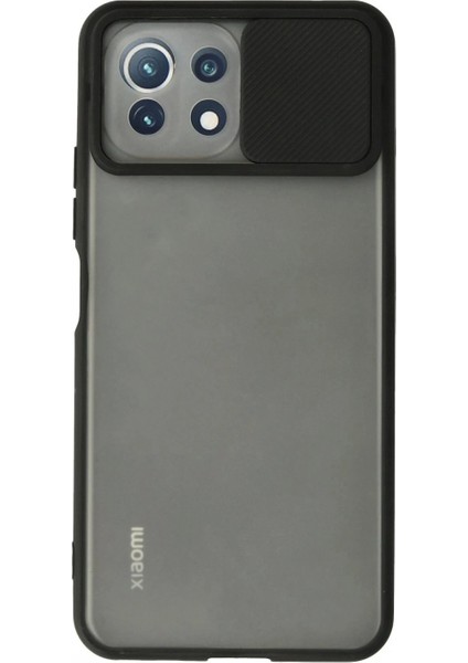 Ieg Xiaomi Mi 11 Lite Kılıf Palm Buzlu Kamera Sürgülü Silikon - Siyah