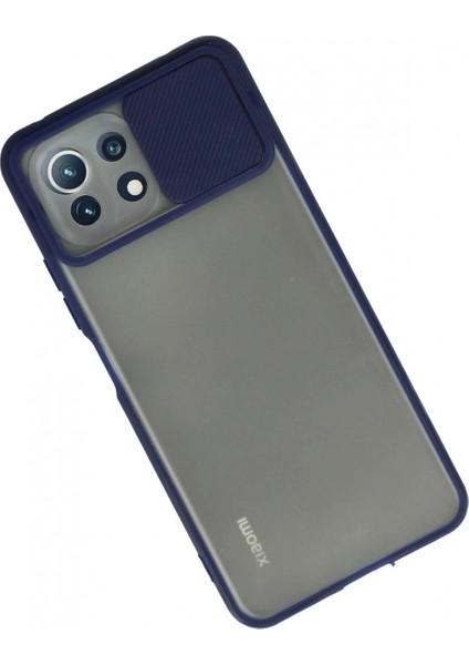 Ieg Xiaomi Mi 11 Lite Kılıf Palm Buzlu Kamera Sürgülü Silikon - Lacivert fiyatları